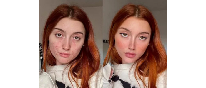 فوبيـــــــا "فلتـــــرة" الوجــــوه.. الجمال الطبيعي في خبر كان!