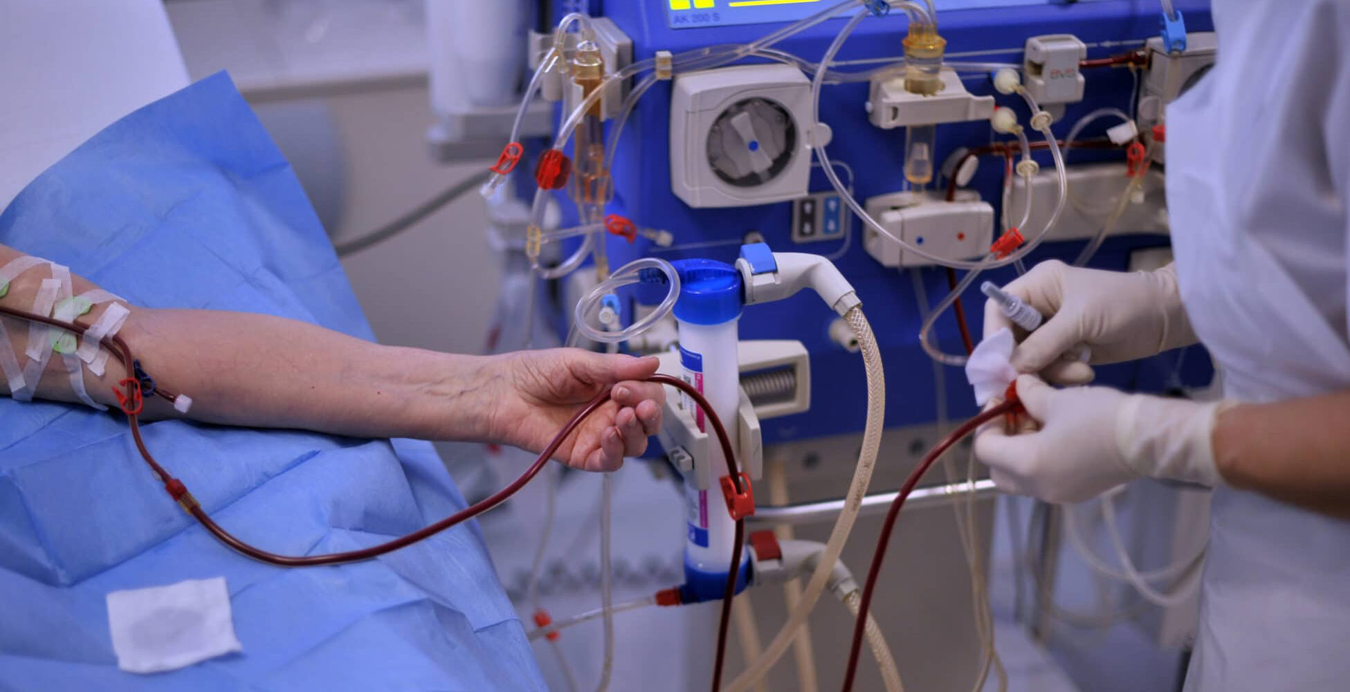 عدته مشروعاً واعداً ..  الصحة تعتمد (الديلزة البريتونية) لعلاج مرضى الفشل الكلوي