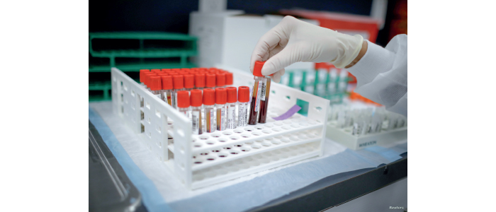 لقاح يكسر حدود الطب.. القضاء على السرطان قبل ظهوره بـ 20 عاماً